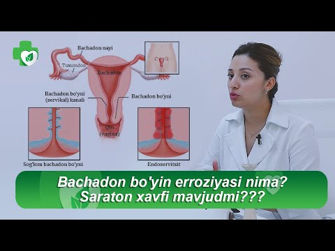 Video: Gedonizm Nima?