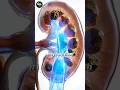 5-Minute Secret Drink to Flush Kidney Stones & Stop Bloating! ✨
