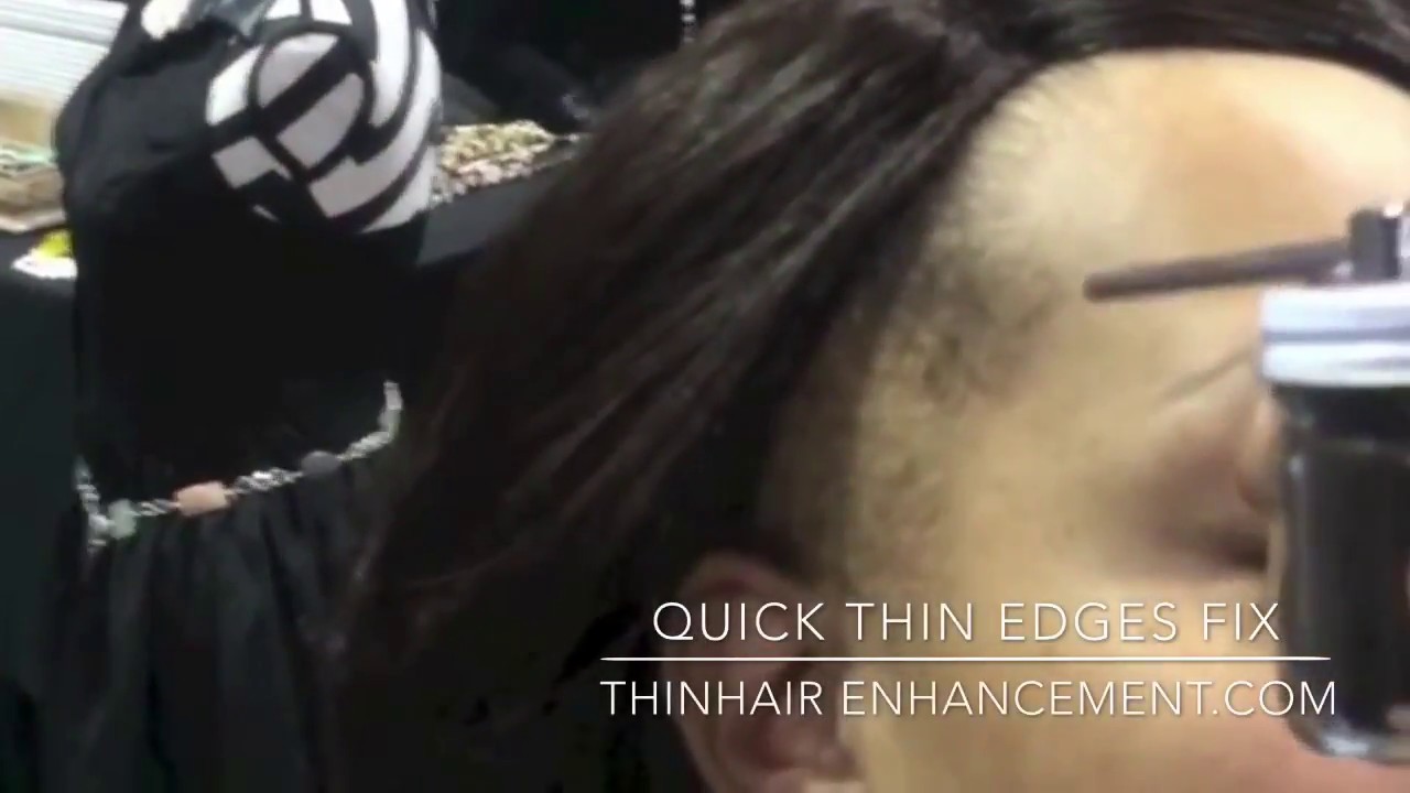 Quick Help For Thin Edges Hair Enhancement You Quick Help For Thin Edges Hair Enhancement