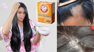 Bicarbonato Para detener la Caida, hacer crecer el cabello y Eliminar la Caspa. fashionbycarol