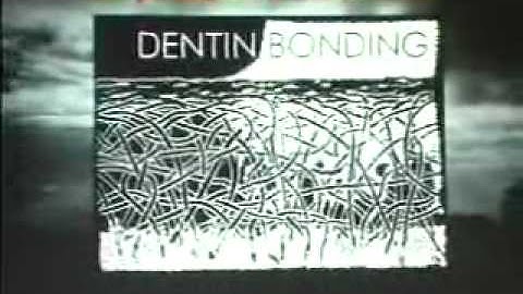 First of two lectures from Dr. Pascal Magne performed in the USC some years ago