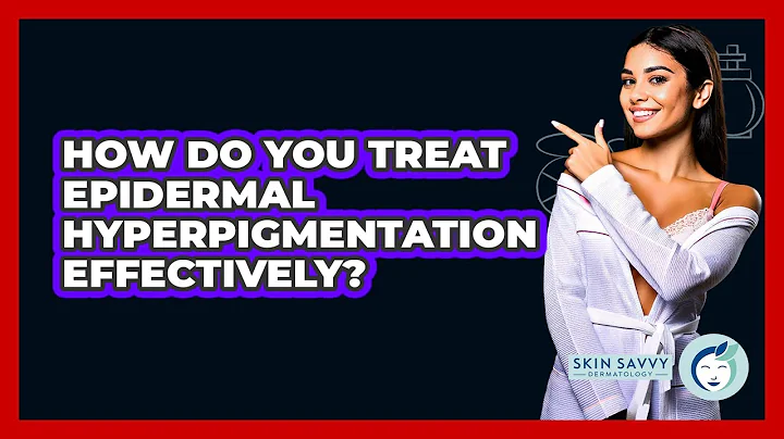 How Do You Treat Epidermal Hyperpigmentation Effectively? - Skin Savvy Dermatology