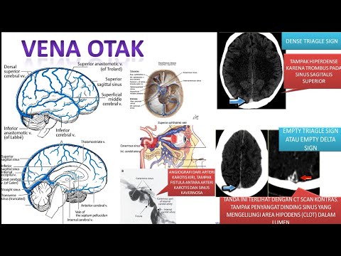 Video: Lengkung Vena Dorsal Anatomi, Fungsi & Diagram Kaki - Peta Tubuh