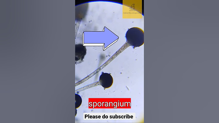 How Fungus look like under the Microscope #microscope #fungus #mikroskop #caitlin #mr_indianhacker