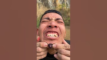 How I Cured a Bug Bite with Yogurt in the Wild Survival Hacks