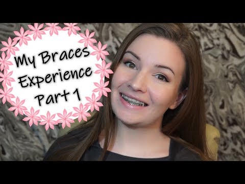 My Braces Experience - Part 1 - YouTube