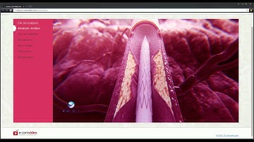 ZORG VIDEO HULP - een interactieve Patienteninformatie video-oplossing