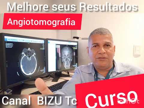 Vídeo: Angiografia Por Tomografia De Coerência óptica Para O Segmento Anterior