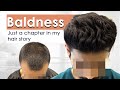 Grade 3 baldness hair transplant in new roots  hair transplant results