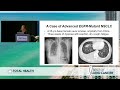 2023 best of lung targeted therapies in lung cancer