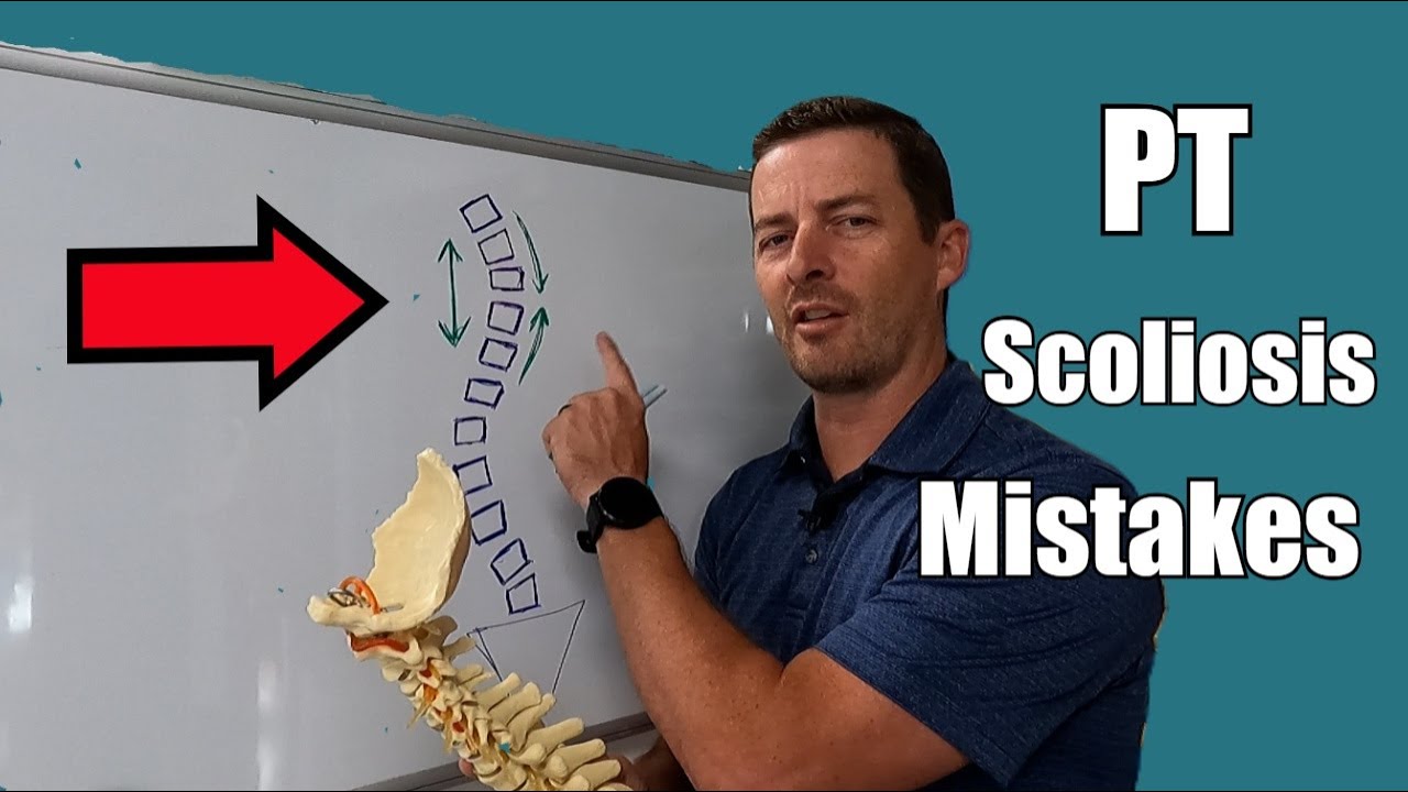 The #1 Mistake Most PTs Make Treating Scoliosis