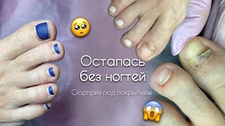 КЛИЕНТКА ОСТАЛАСЬ БЕЗ НОГТЕЙ 😢Отдавили ногти. Неприятный сюрприз под гель-лаком 😞