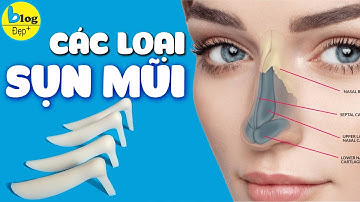 Các loại sụn nâng mũi tốt nhất hiện nay