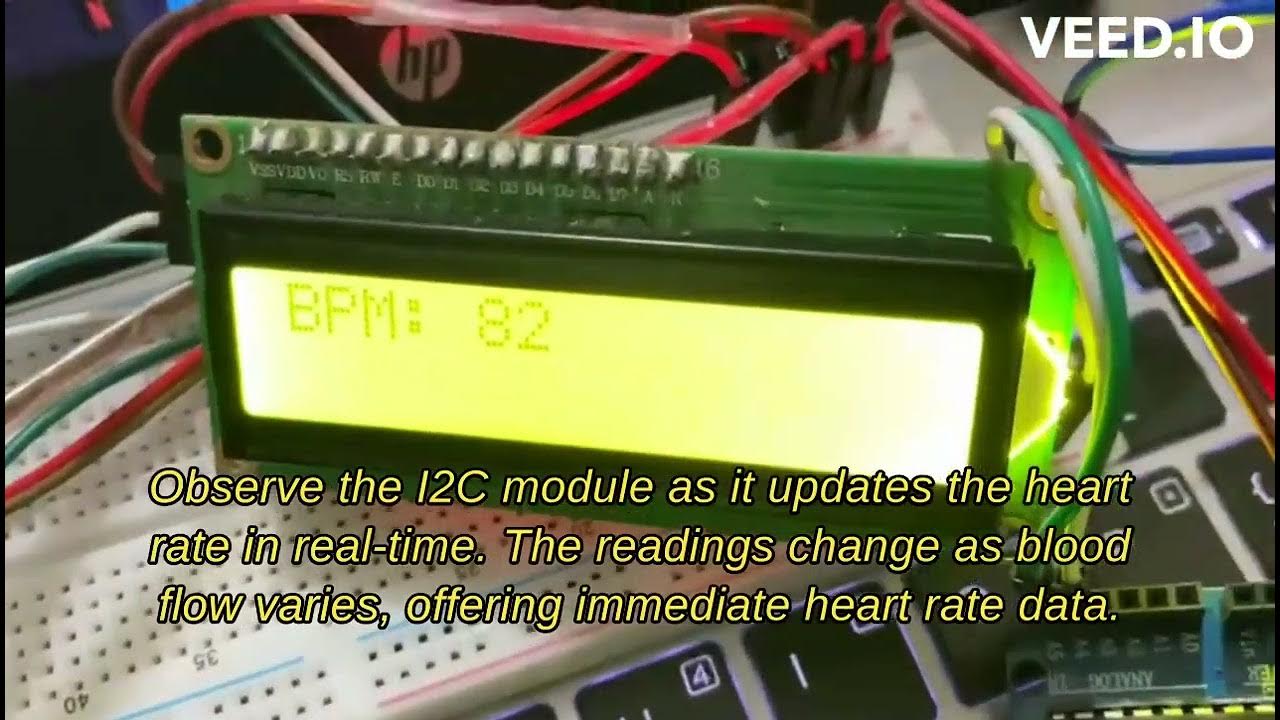 Innovative Health Monitoring System Using Arduino: Fall Detection and ...