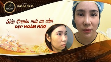 Lột Xác Sau Siêu Combo Nâng Mũi+Cắt Mí+Độn Cằm