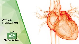 Atrial fibrilation on The First Aid Show