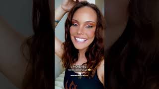 Incredibil Veneer Review: The Best Veneer On The Market