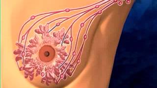 Axillary Lymph Node Dissection by Lange Productions