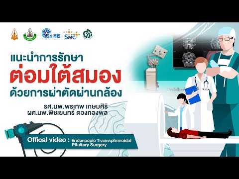 แนะนำการผ่าตัดส่องกล้องต่อมใต้สมอง - Endoscopic Endonasal Transsphenoidal Pituitary Surgery