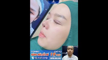 Combo Nâng Mũi + Cắt Mí Giá Ưu Đãi Chỉ Từ 19 Triệu