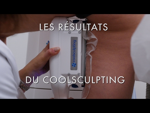 Vidéo: CoolSculpting Pour L'intérieur Des Cuisses: Procédure, Coût, Effets Secondaires Et Photos