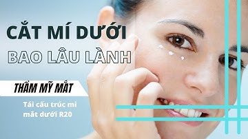 Cắt mi mắt dưới bao lâu sẽ lành I Thẩm mỹ Anvee