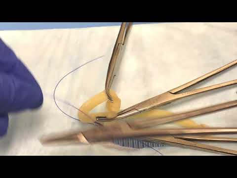 Clamping and ligating ovarian pedicle