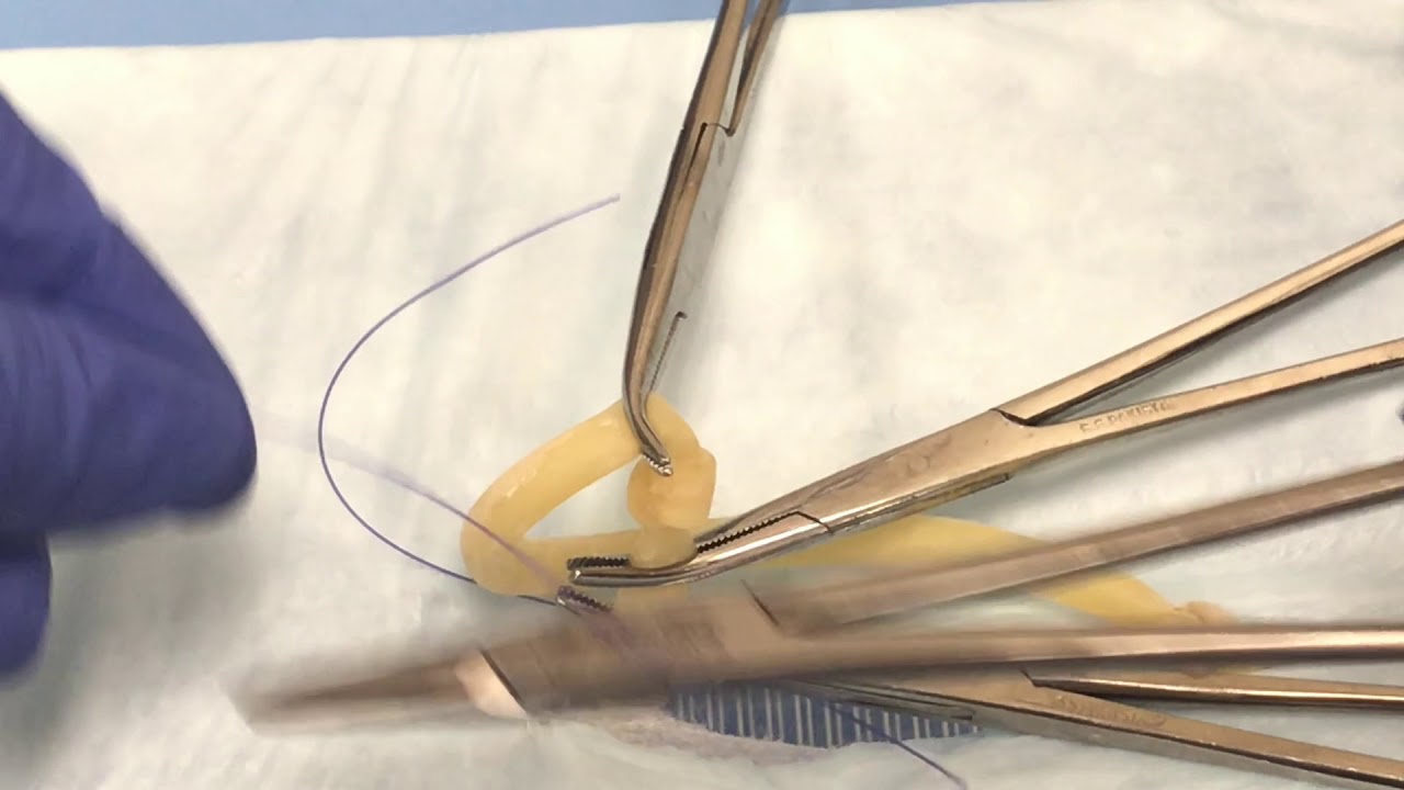 Clamping and ligating ovarian pedicle YouTube