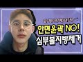 남자안면윤곽 NO! 남자심부볼지방제거로 V라인 완성