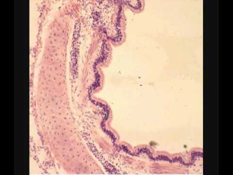 ЛЕГКОЕ  LUNG  гистологическое строение