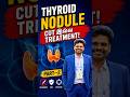 Thyroid Nodule Explained | Cancer ஆ? Surgery தேவையா? | Part-2