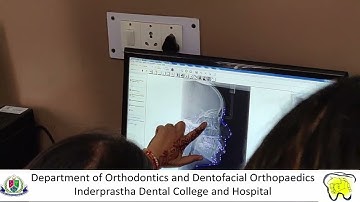 Computerized cephalometric tracing of digital radiographs