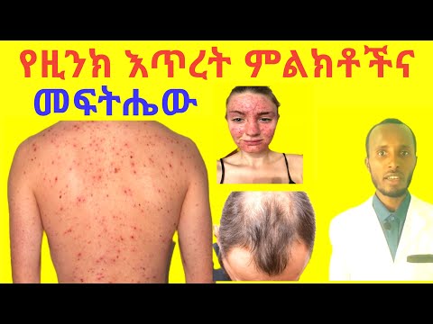 ቪዲዮ: ዚንክ አዮዳይድ መርዛማ ነው?