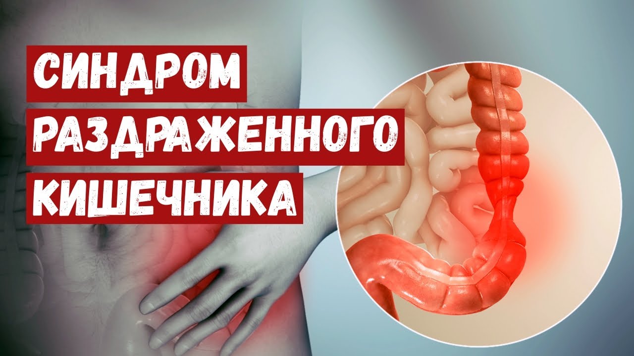 Синдром Раздраженного Кишечника - YouTube