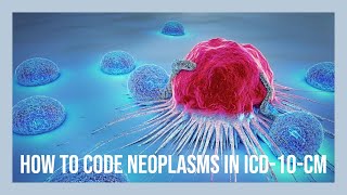 CODING NEOPLASMS IN ICD10CM