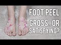 We tried a crazy foot peel  shorts