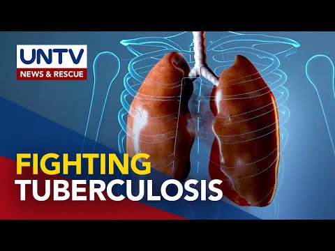 Video: 4 Mga Paraan upang Mabilis na Mapadali ang Mga Sintomas ng Lung Sarcoidosis