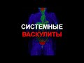 Системные васкулиты