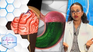 ማጅራት ገትር Meningitis እና “የጨጓራ ሕመሞች በአግባቡ ከታከሙ  ይድናሉ…… “ የዘርፉ ባለሙያ፡፡