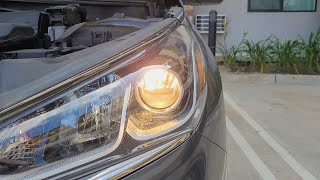 Hyundai Sonata (2015-2019): Low Beam Headlight Bulbs Replacement.