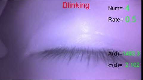 CSCI/EENG 512 Spring 2014 Final Project - Pupil Detection