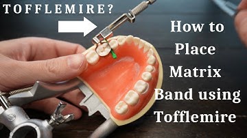 How to Place Matrix Band Using the Tofflemire