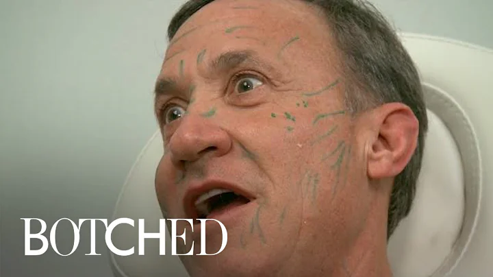 Dr. Terry Dubrow Freaks Out Paul With Face Filler ...