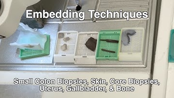 Embedding Techniques for Histotechs: How to Properly Embed Tissue