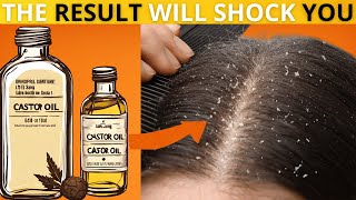 The Surprising Benefits Of Castor Oil You Didn't Know!