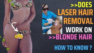 Does Laser Hair Removal Work on Blonde Hair | Expert Recommendation