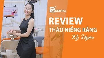 [Review tháo niềng răng]: #16 Kết quả niềng răng của Kỳ Uyên