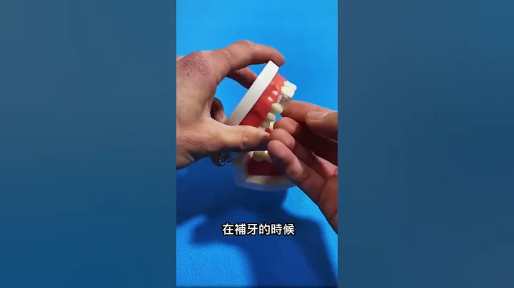 自己在家也能補牙了，缺牙、斷牙、牙洞、牙縫過大，3分鐘補好 - 天天要聞