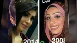 شاهد فنانات خليجيات بعد عمليات تجميل