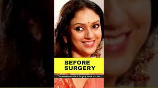 Aditi Rao Hydari: Can You Guess Which Surgery She Got Done? | Bollywood News | Her Zindagi #shorts